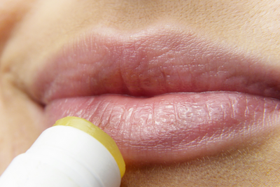Trockene Lippen – Die Ursache